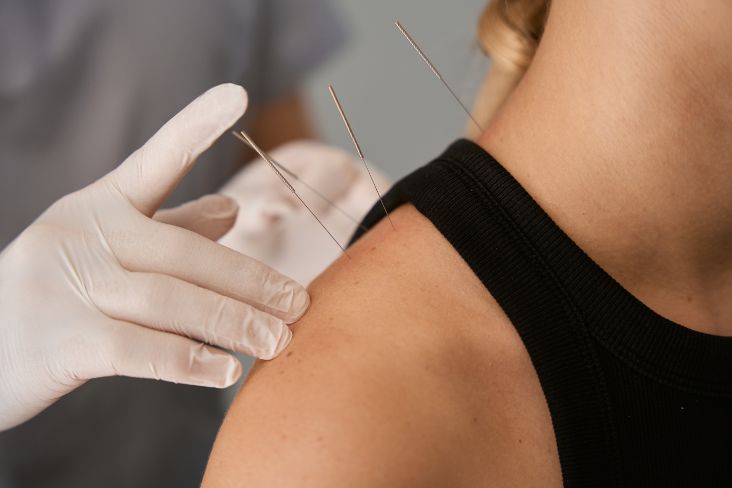 Can acupuncture help with weight loss